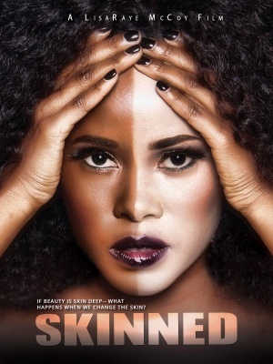 Skinned