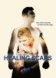 Healing Scars