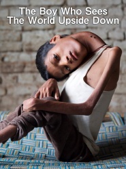 The Boy Who Sees the World Upside Down