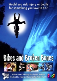 Bikes and Broken Bones